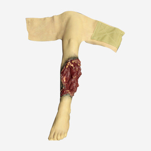 WW3-752 Partial Leg Amputation(Left)